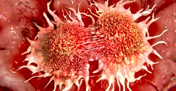 cancer-cells