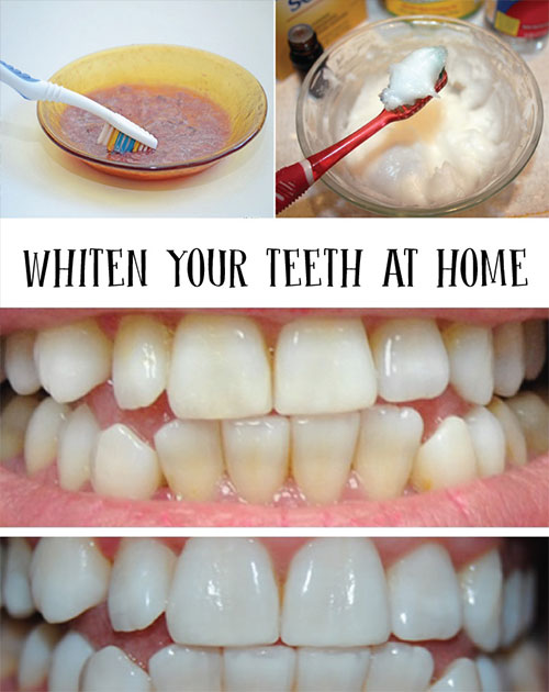 toothbrush-beauty-hacks-teeth-whitening