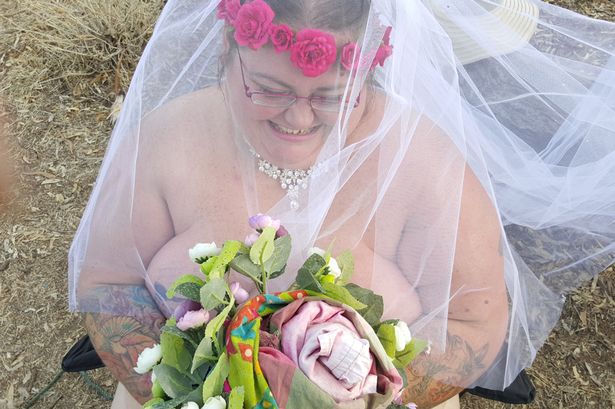pay-woman-married-naked-after-waking-from-coma