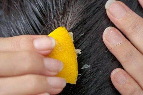 lemon-juice-scalp