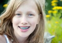 Šķībi zobi bērniem: kā izlabot, profilaktika, rašanās iemesli
